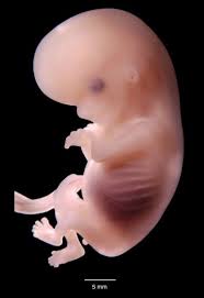 embrión humano