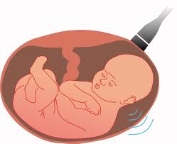 dibujo de un feto