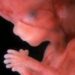 feto humano